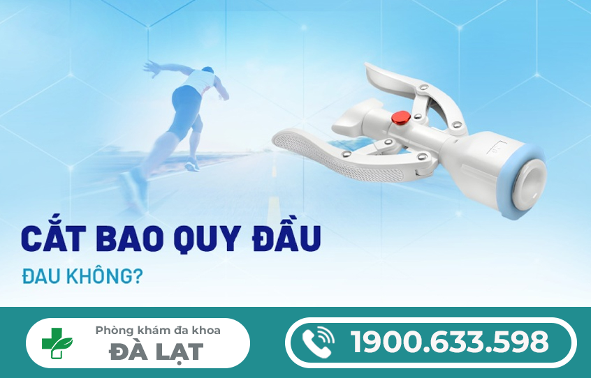 Hình ảnh minh họa